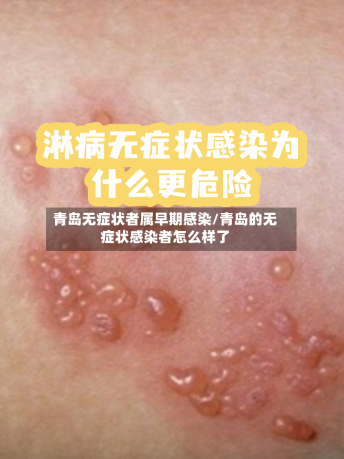 青岛无症状者属早期感染/青岛的无症状感染者怎么样了-第3张图片