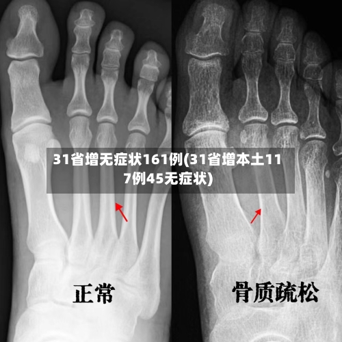 31省增无症状161例(31省增本土117例45无症状)
