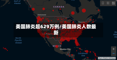 美国肺炎超629万例/美国肺炎人数最新-第2张图片