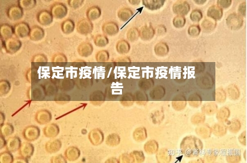 保定市疫情/保定市疫情报告