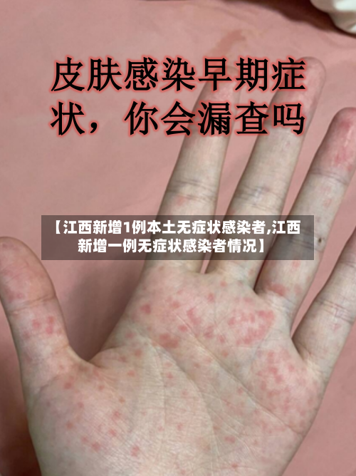 【江西新增1例本土无症状感染者,江西新增一例无症状感染者情况】