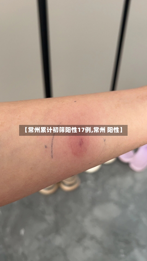 【常州累计初筛阳性17例,常州 阳性】