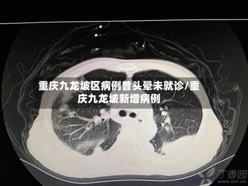 重庆九龙坡区病例曾头晕未就诊/重庆九龙坡新增病例-第2张图片