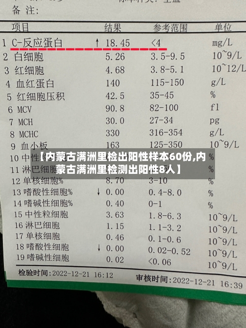 【内蒙古满洲里检出阳性样本60份,内蒙古满洲里检测出阳性8人】-第3张图片