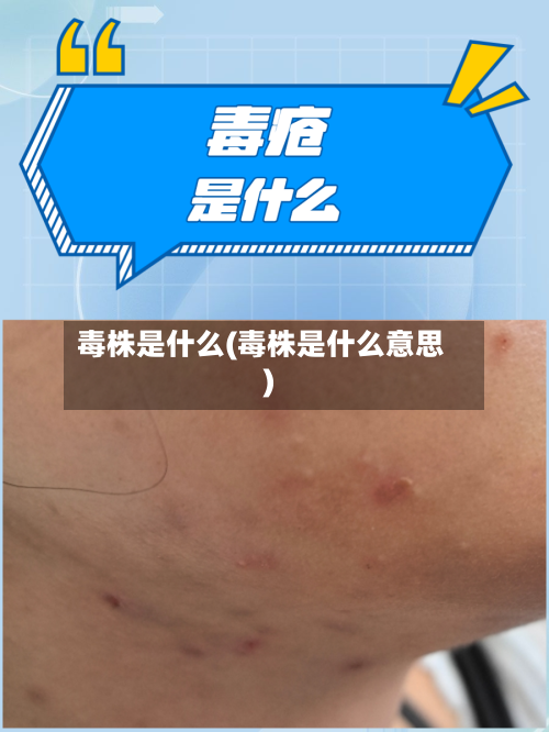 毒株是什么(毒株是什么意思)