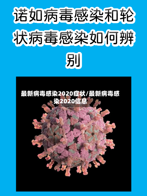最新病毒感染2020症状/最新病毒感染2020信息
