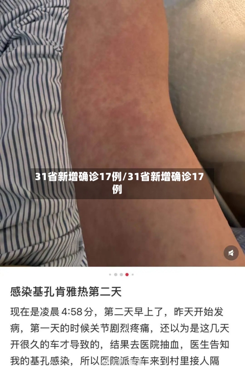 31省新增确诊17例/31省新增确诊17例-第2张图片
