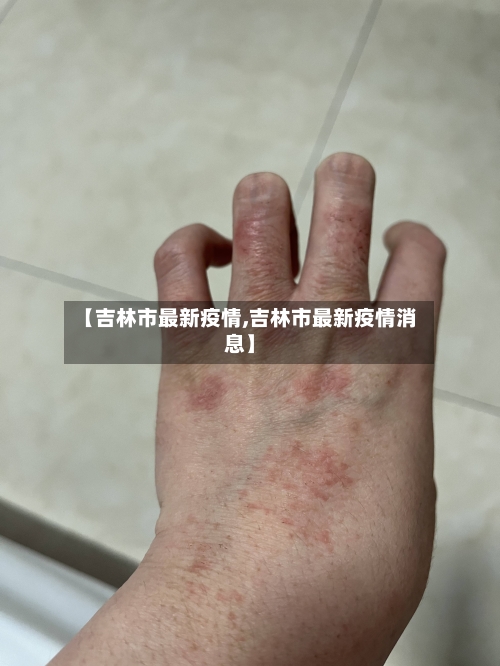 【吉林市最新疫情,吉林市最新疫情消息】-第2张图片