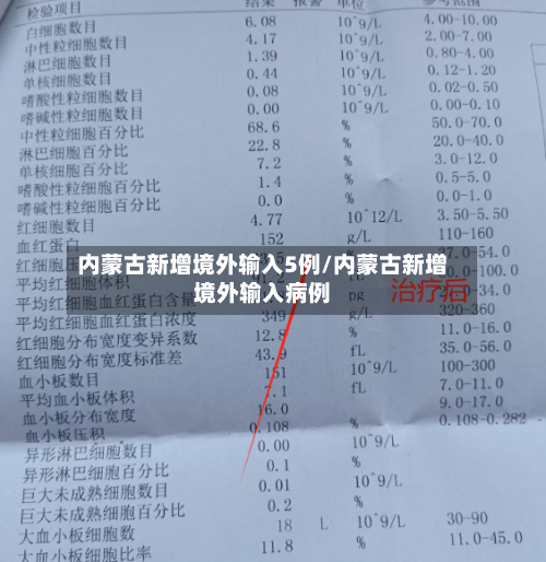 内蒙古新增境外输入5例/内蒙古新增境外输入病例