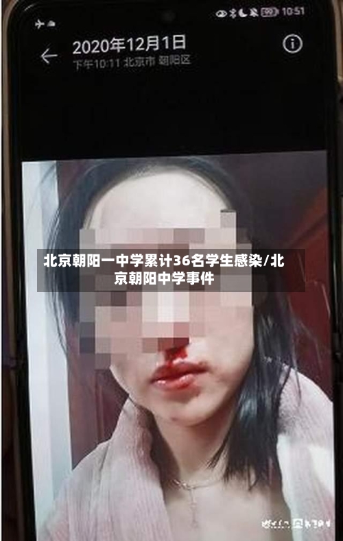 北京朝阳一中学累计36名学生感染/北京朝阳中学事件-第2张图片