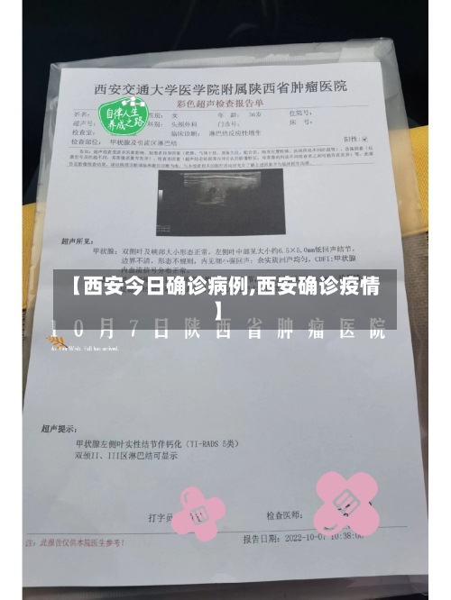 【西安今日确诊病例,西安确诊疫情】-第2张图片