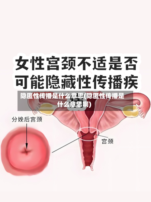 隐匿性传播是什么意思(隐匿性传播是什么意思啊)-第2张图片