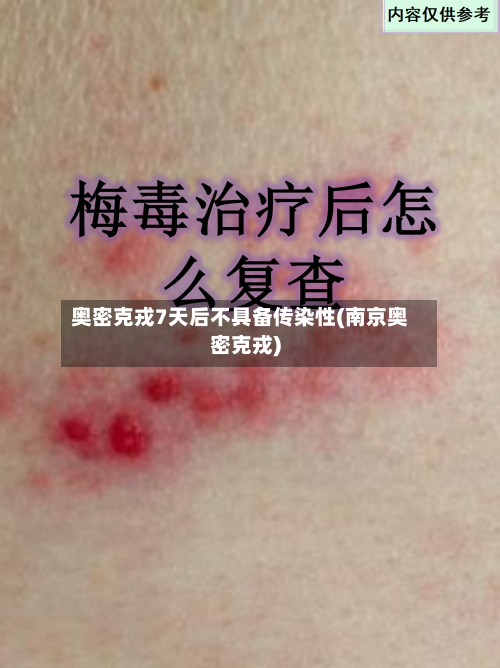 奥密克戎7天后不具备传染性(南京奥密克戎)