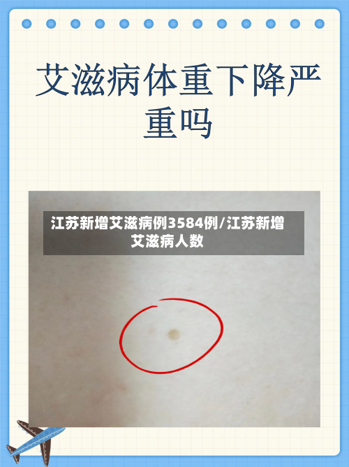 江苏新增艾滋病例3584例/江苏新增艾滋病人数