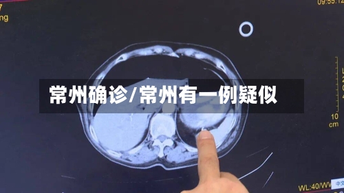 常州确诊/常州有一例疑似-第3张图片