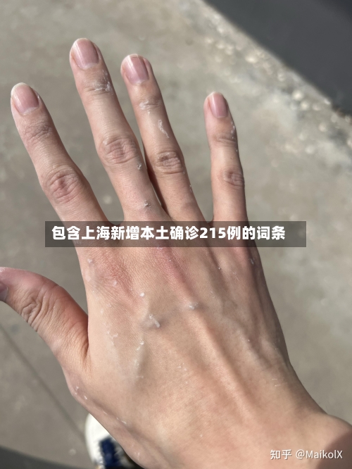 包含上海新增本土确诊215例的词条