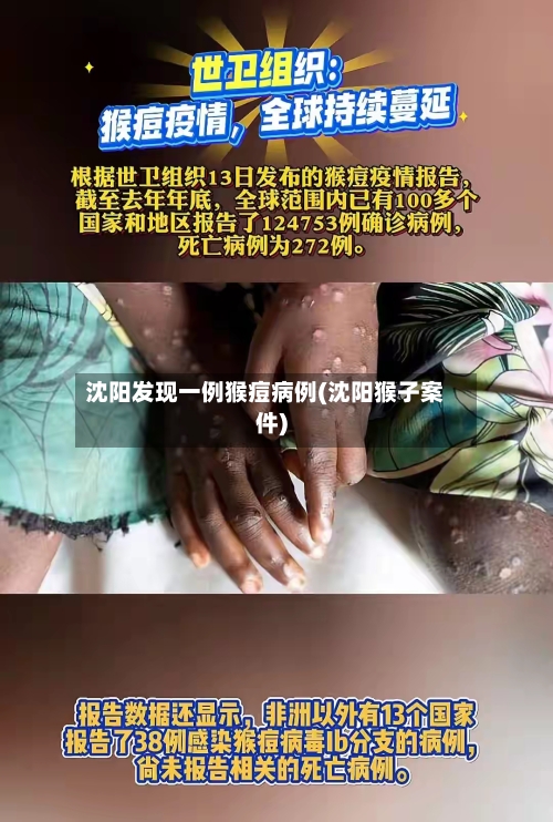 沈阳发现一例猴痘病例(沈阳猴子案件)