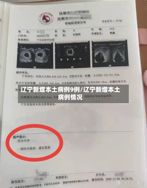 辽宁新增本土病例9例/辽宁新增本土病例情况