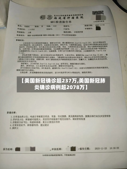 【美国新冠确诊超237万,美国新冠肺炎确诊病例超2078万】