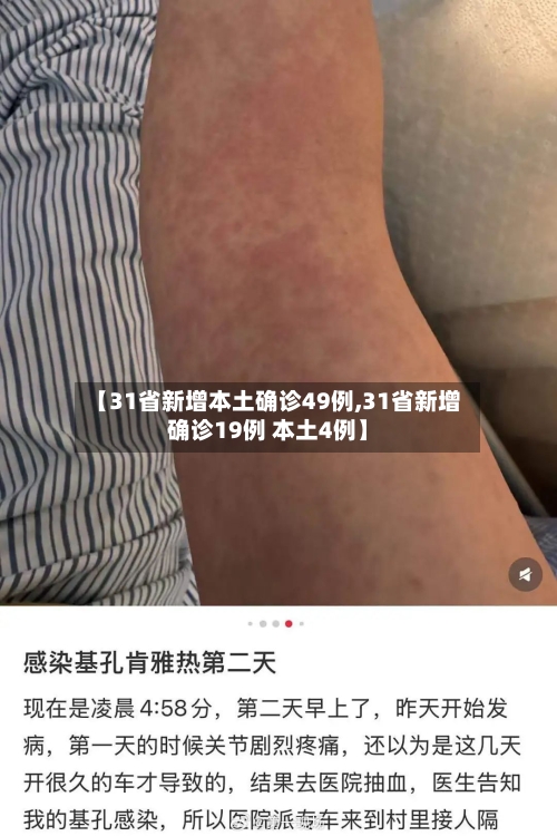 【31省新增本土确诊49例,31省新增确诊19例 本土4例】-第2张图片