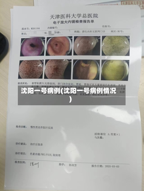 沈阳一号病例(沈阳一号病例情况)-第3张图片