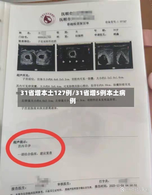 31省增本土127例/31省增5例本土病例