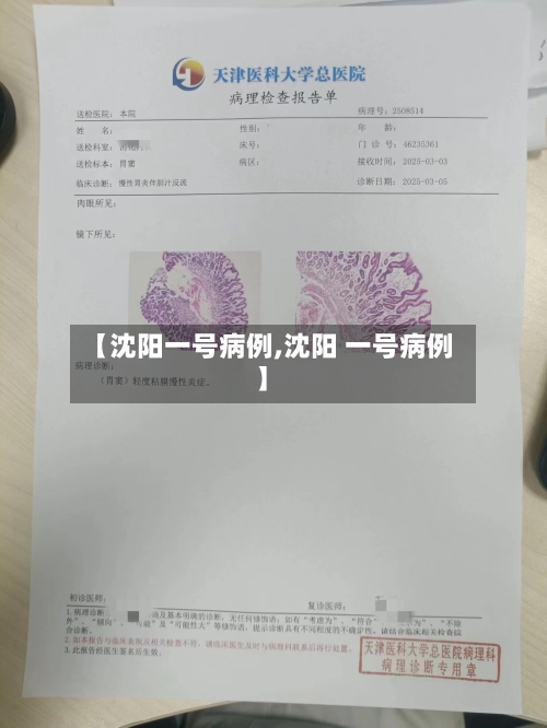【沈阳一号病例,沈阳 一号病例】-第3张图片
