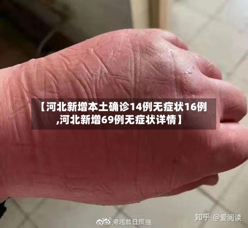 【河北新增本土确诊14例无症状16例,河北新增69例无症状详情】