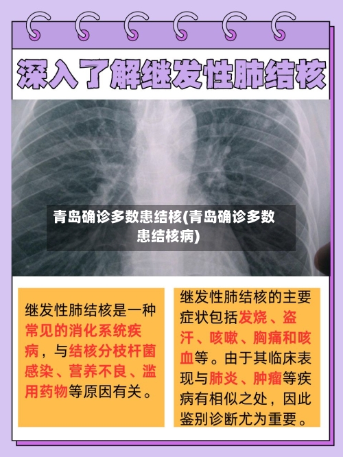 青岛确诊多数患结核(青岛确诊多数患结核病)-第2张图片