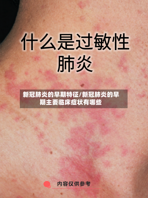 新冠肺炎的早期特征/新冠肺炎的早期主要临床症状有哪些-第2张图片