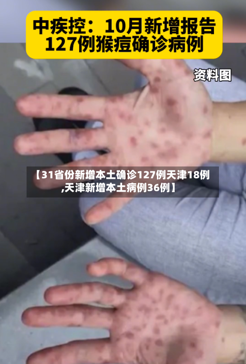 【31省份新增本土确诊127例天津18例,天津新增本土病例36例】-第3张图片